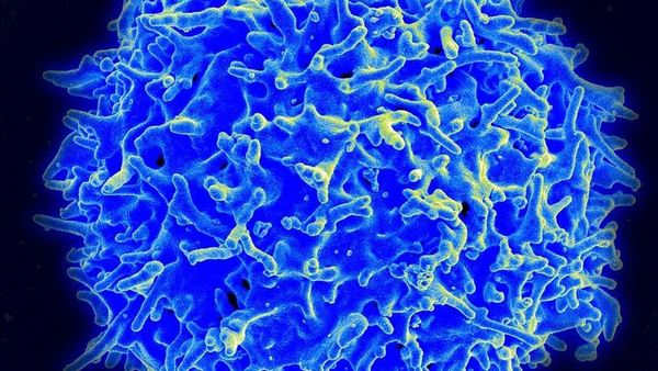 Scanning electron micrograph of a healthy human T cell, colored blue, with a ruffled surface covered in short projections.