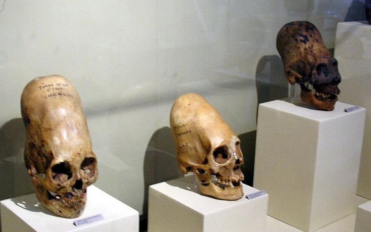 Display case with several elongated human skulls.